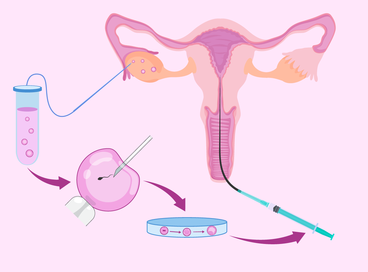 F Condation In Vitro Doctor Tours